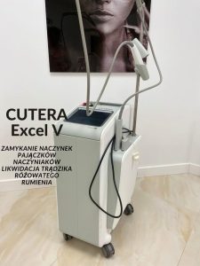 Cutera Excel V - Zamykanie naczynek dermatolog Gdańsk