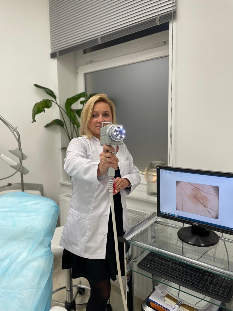 Wideodermatoskopia – Fotofinder: diagnostyka czerniaka, dosgnostyka raka skóry